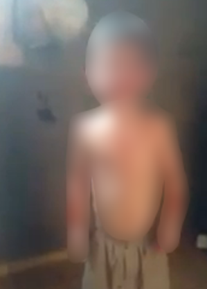 Imagem de vídeo que mostra menino com sangue pelo corpo