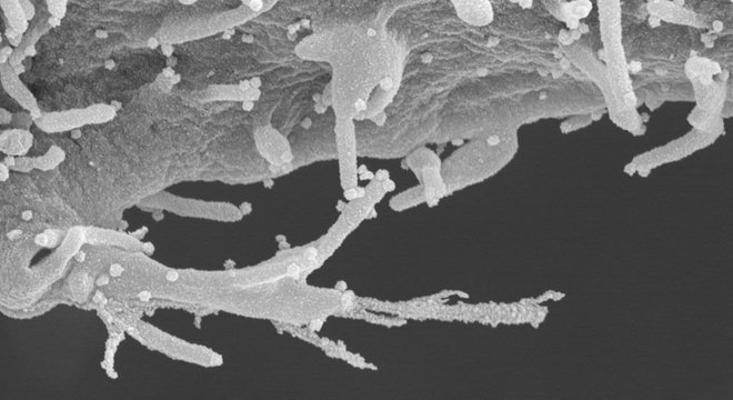 As imagens reveladas pelo estudo mostram células humanas infectadas com um detalhamento inédito