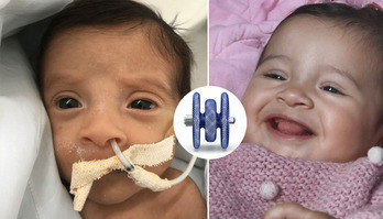 Bebê prematura com problema no coração sorri após pôr dispositivo (Bebê prematura com sério problema no coração sorri após implantar dispositivo que salvou sua vida; assista)