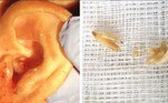 Um homem reclamando de dor, coceira e sangramento em uma das orelhas descobriu que o órgão era lentamente devorado por vermes carnívoros. O homem de 64 anos precisou ficar hospitalizado por cinco dias no Hospital Pedro Hispano, em Matosinhos, Portugal, até se recuperar