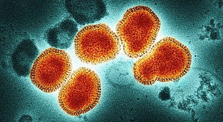 Gripe Espanhola foi causada por um tipo de Influenza A
