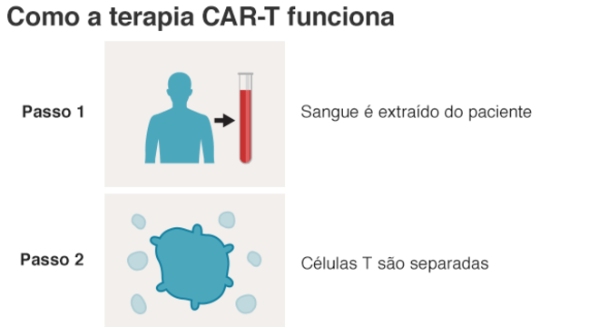 infografico explica como funciona o CAR-T