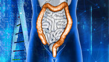 EUA aprovam primeiro medicamento oral contra a doença de Crohn    