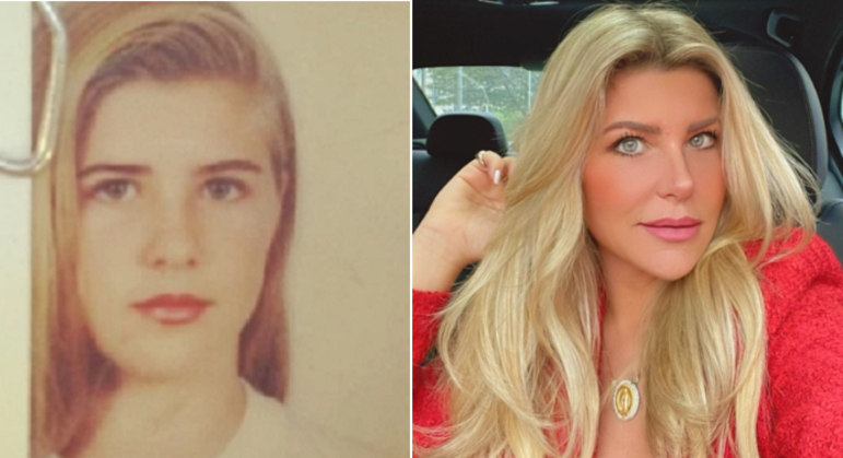 Iris Stefanelli, antes e depois, em montagem.