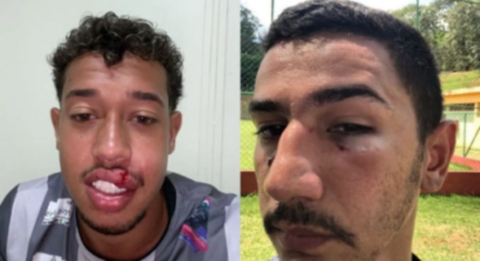 Matheus Mosquito e Richard Cabelo agredidos por jogadores do Paulista 