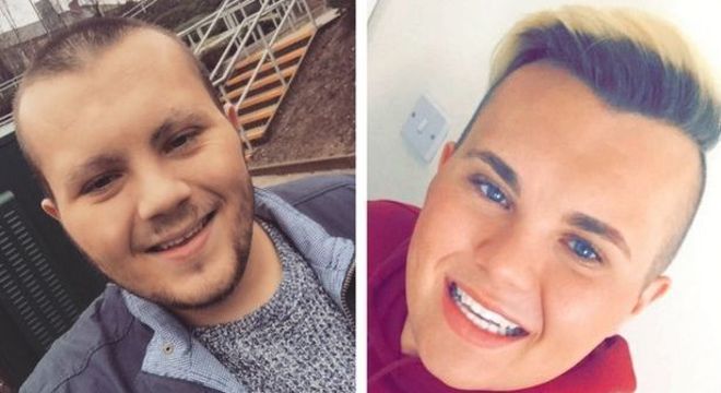 Jack 'Beckham' antes e depois dos procedimentos estéticos