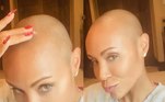 Jada Pinkett Smith fala com bom humor sobre perder os pelos do corpo