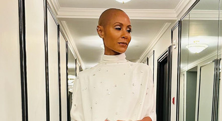 Atriz foi diagnosticada com alopecia em 2018