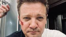 Médico de Jeremy Renner comenta recuperação do ator: 'Não consegue lidar com tanta dor'