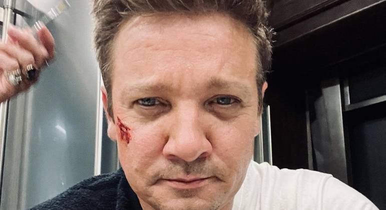 O que se sabe at&eacute; o momento sobre o grave acidente de Jeremy Renner, astro  da Marvel? - Entretenimento - R7 Famosos e TV
