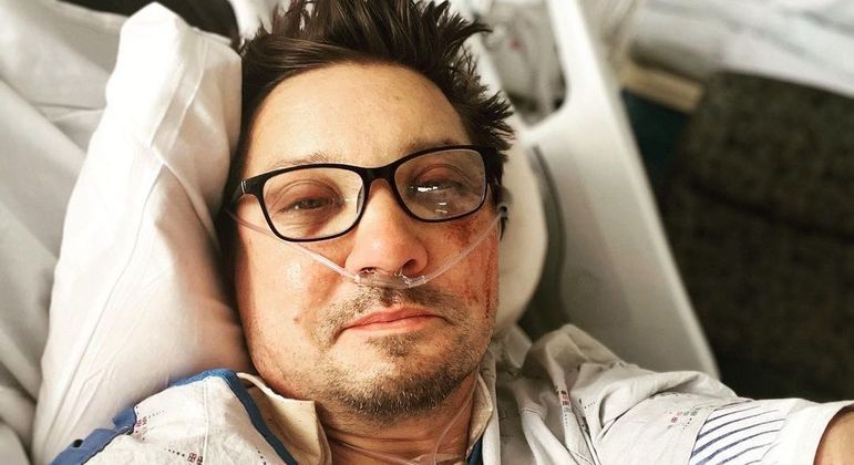Jeremy Renner passou por duas cirurgias após o acidente