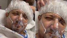 Jeremy Renner recebe massagem da irmã no hospital; veja a cena fofa