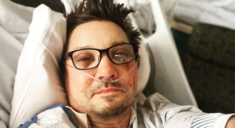Jeremy Renner se recupera após ser atropelado por máquina que remove neve
