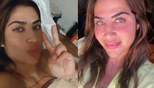 Jéssica Beatriz Costa, filha do cantor Leonardo, faz cirurgia para levantar e colocar silicone nos seios 