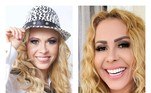 Fora isso, nos últimos anos, se submeteu a procedimentos mais modernos, como harmonização facial e preenchimento labial