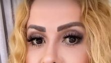 Joelma faz alerta sobre sequelas da Covid-19: 'Fiquei mal de novo'