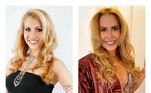 Desde que se tornou famosa, Joelma também recorreu a diversos procedimentos estéticos para mudar a aparência. A cantora já empinou o nariz, corrigiu os dentes, contornou o queixo, fez lipoaspiração e pôs silicone. Além disso, nos últimos anos  submeteu-se a procedimentos mais atuais, como harmonização facial e preenchimento labial