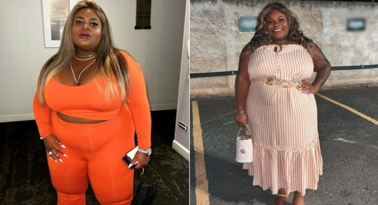 Jojo TodynhoA campeã do reality show A Fazenda 12 fez lipoaspiração nas costas algumas vezes e aplicou a gordura retirada no bumbum. Ela também tem implantes de silicone nos seios. No entanto, Jojo revelou em entrevista para o colunista Leo Dias, que só mexeu no corpo mesmo: “Não fiz nenhum procedimento no rosto. Estou cuidando mais da minha pele, dando mais atenção e recebendo os cuidados pela minha dermatologista