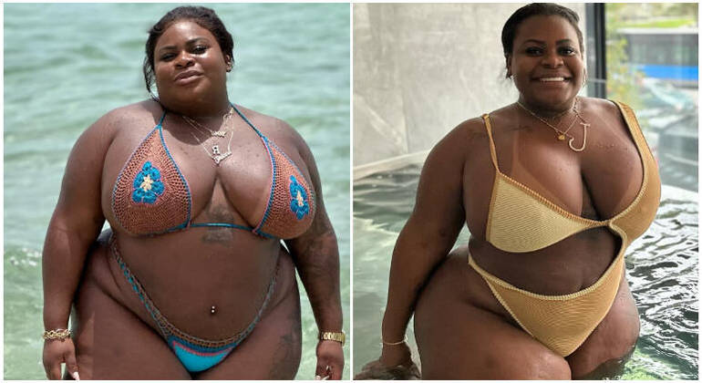 Jojo Todynho antes e depois da bariátrica