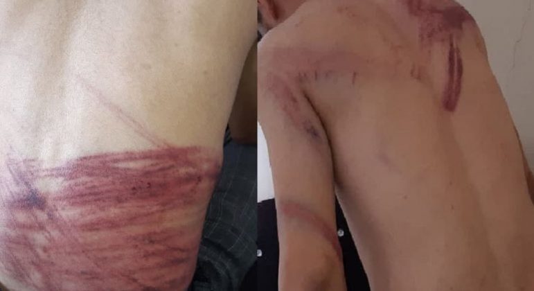 Taqi Daryabi e Nematullah Naqdi ficaram com marcas profundas por todo o corpo