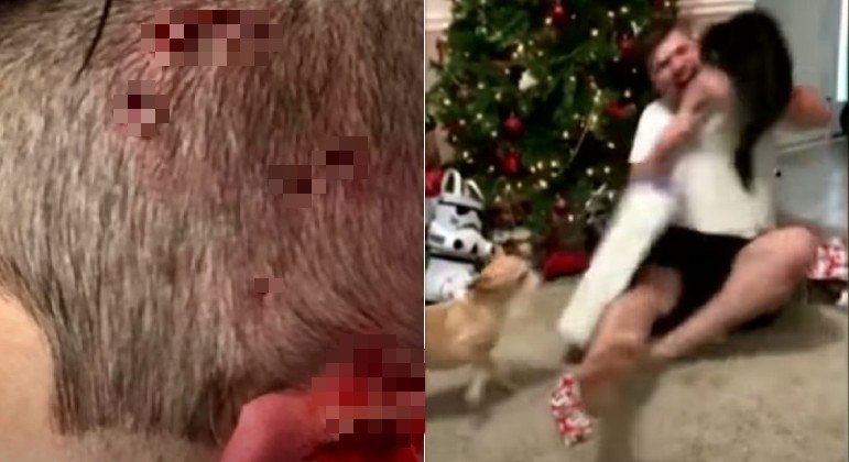 Excitação de jovem ao ganhar PlayStation 4 fez provocou terrível ataque felino