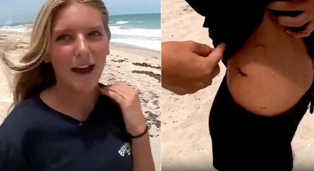 Jovem que lutou contra tubarão na Flórida