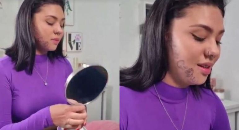Tayane Caldas, de 18 anos, começou sessões para a retirada da tatuagem no rosto feita pelo ex

