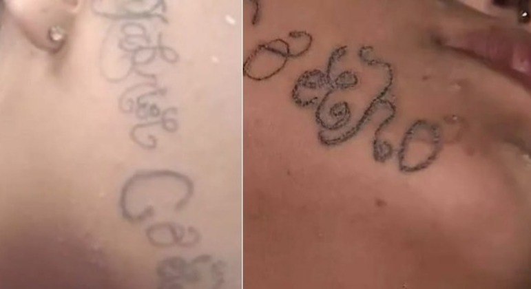 Jovem que teve rosto tatuado pelo ex recebe ajuda para retirar tatuagem, Vale do Paraíba e Região