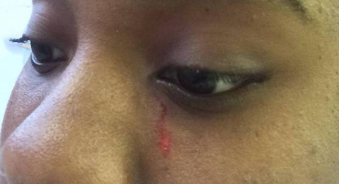Jovem diz ter sido agredida no rosto por senhora de 62 anos em São Paulo