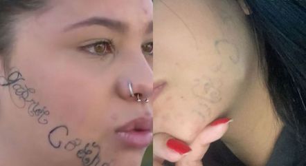 Tayane mostra antes e depois dos procedimentos