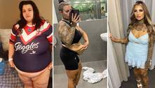 Australiana bomba nas redes sociais após perder mais de 75 kg: 'Orgulho de quem me tornei'