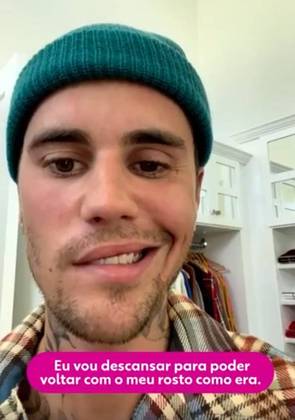 Justin informou que vai descansar - e seguir o tratamento, claro - para que seu rosto possa voltar ao normal. Estamos todos na torcida. 
