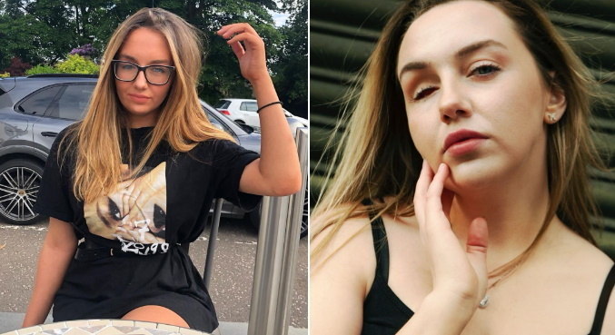 Mais confiante, Katie está postando fotos sem a prótese ocular
