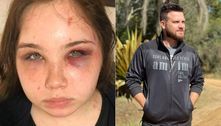 Filha de cantor sertanejo acusa o pai de agressão e diz que foi ameaçada com arma