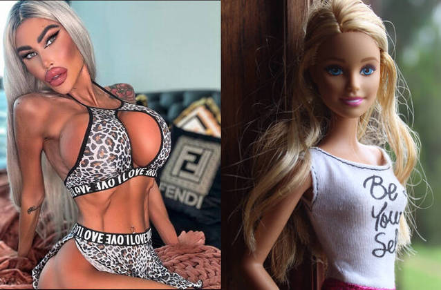 Ken era namorado da Barbie. A boneca, criada em 1959 pela Mattel, também inspirou alterações em algumas mulheres. É o caso da australiana Tara Jayne McConachy, de 34 anos, que gastou mais de R$ 1 milhão em procedimentos, mas não pintou o cabelo de loiro. 