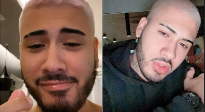 O funkeiro chegou a mostrar os tufos de cabelo e depois publicou uma foto careca