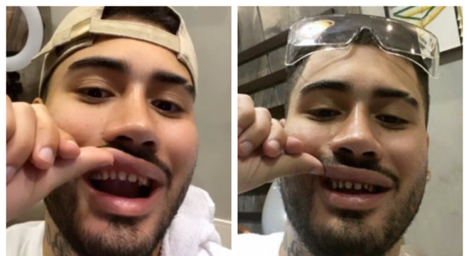 Kevinho Exibe Dentes Sem Lente De Contato E Vira Meme Entretenimento R7 Famosos E Tv