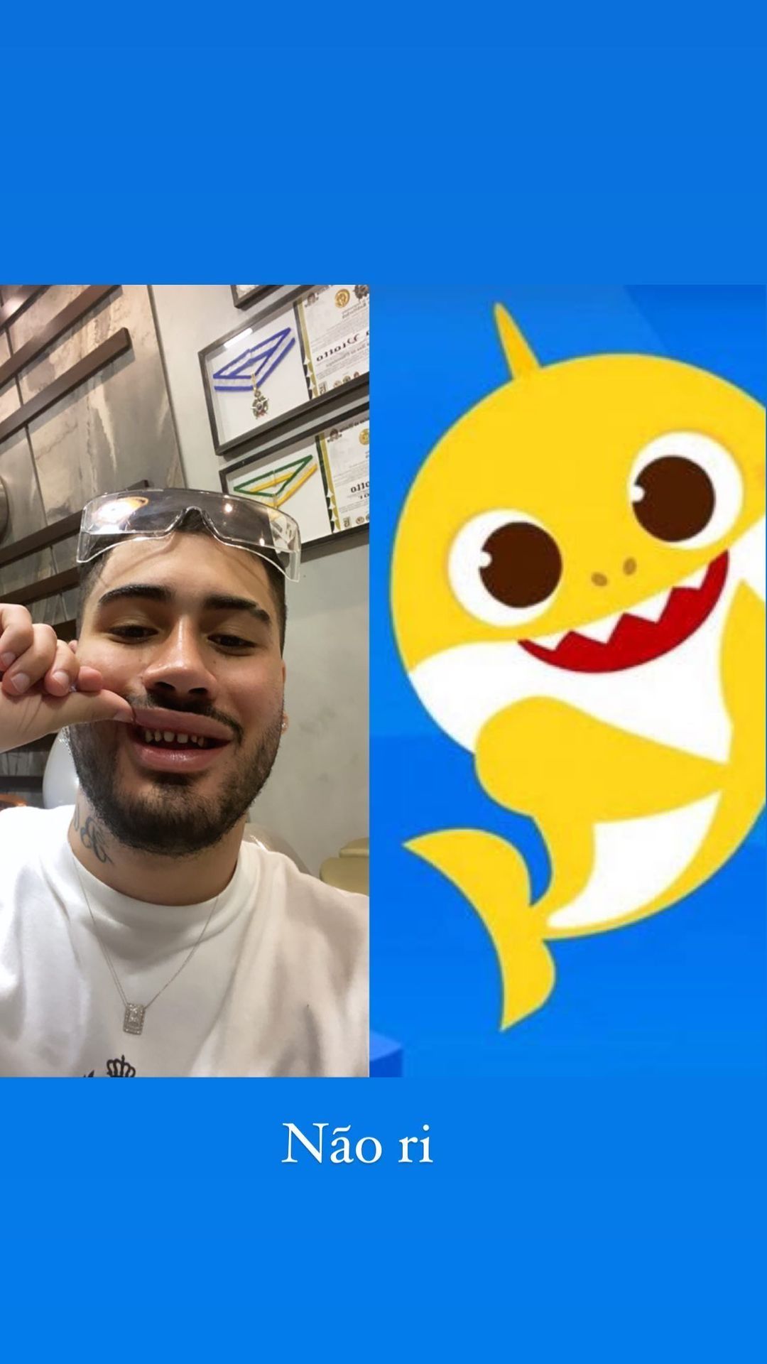 Kevinho Exibe Dentes Sem Lente De Contato E Vira Meme Entretenimento R7 Famosos E Tv