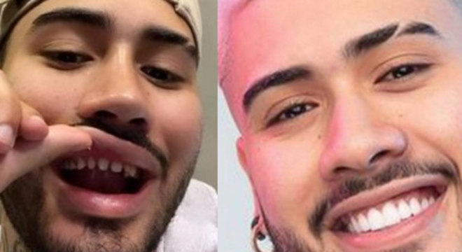 Kevinho virou meme na web após exibir "sorriso natural"