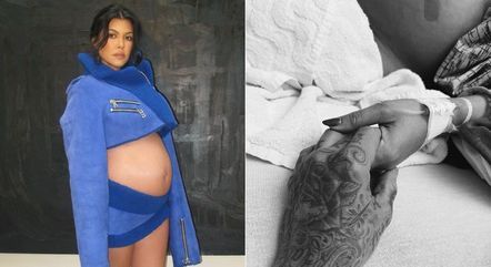 Kourtney Kardashian passou por cirurgia fetal