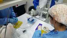 UFMG deve solicitar teste de vacina da covid em humanos em maio 