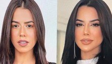 Larissa Tomásia surpreende ao comparar o antes e o depois de harmonização facial: 'Belíssima'