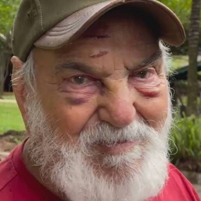 Veterano, de 91 anos, teve ferimentos leves no rosto