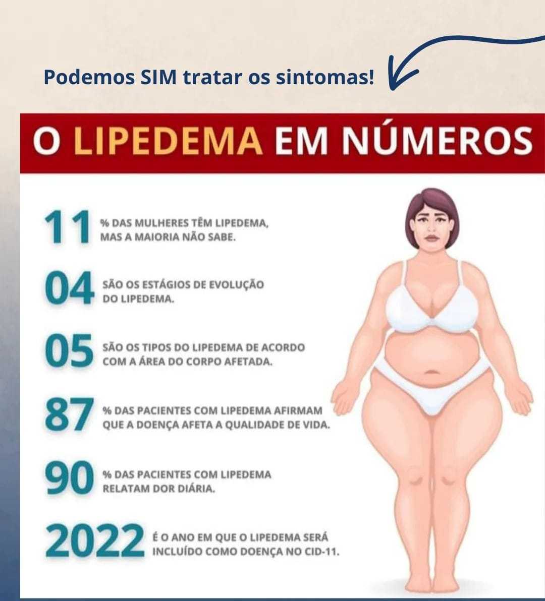 Tratamento para o Lipedema: opções clínicas e cirúrgicas para controlar a  doença genética que afeta as pernas das mulheres