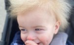 De acordo com informações da Fox5 Atlanta, Katelyn, mãe de Lock, notou que o cabelo do menino começou a mudar a partir dos seis meses. 