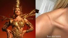 Lore Improta mostra marca no corpo por causa de fantasia de Carnaval: 'Isso dói'