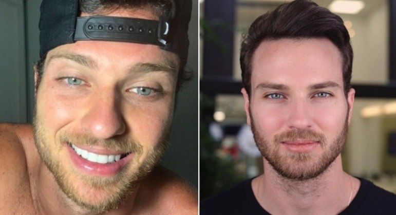 Lucas BissoliO influenciador, de 32 anos, fez os mesmos procedimentos que a namorada, Eslovênia. Além de retocar o sorriso, ele fez harmonização facial. 'O Barão tá com sorriso novo', escreveu ele, que disse que tinha passado por um 'update'