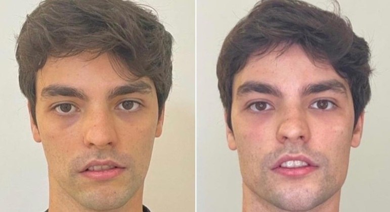 Lucas BleyO influenciador, de 28 anos, foi com Lucas Rangel fazer harmonização facial, no mesmo dia. 'Olha o maxilar de milhões', brincou Rangel ao mostrar Bley nos Stories do Instagram. Acima, você vê o antes e o depois de Lucas Bley 