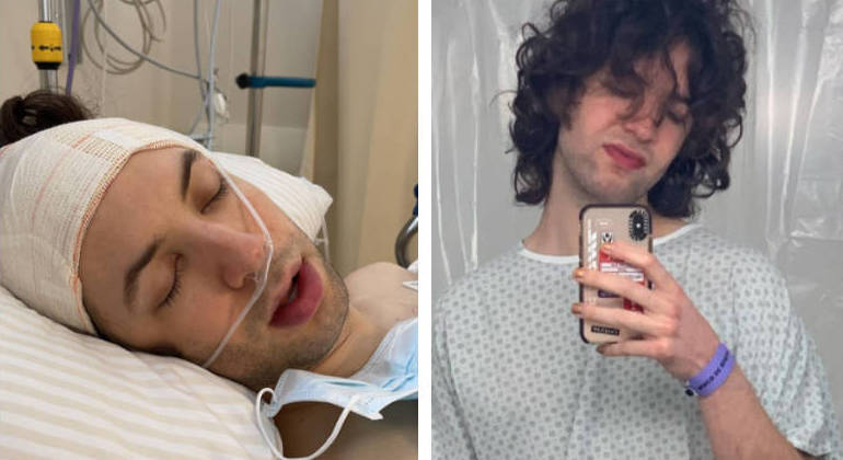 Lucas passou por um procedimento chamado timpanomastoidectomia