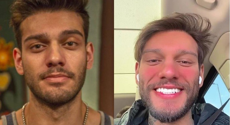 Reverter harmonização facial, como fez Lucas Lucco, pode dar alergia